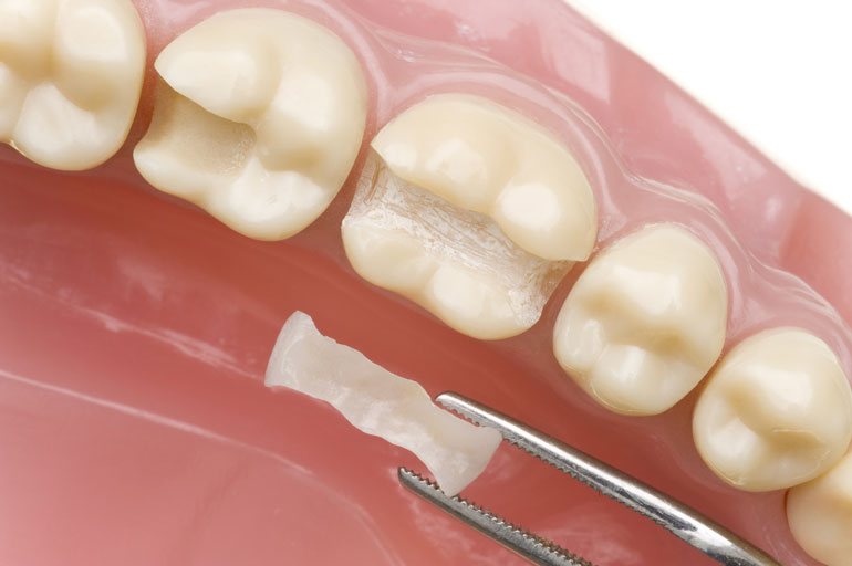 Behandlung Zahn